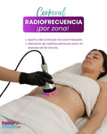 Radiofrecuencia por zona, 30 minutos
